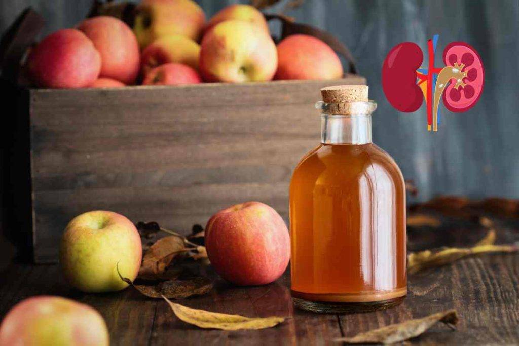 does apple cider vinegar prevent kidney stones