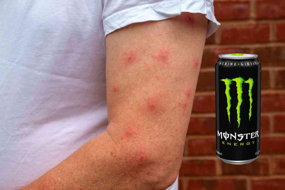 Can You Be Allergic To Monster Energy Drink